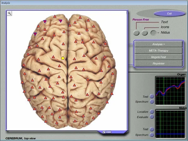 3d body analyzer