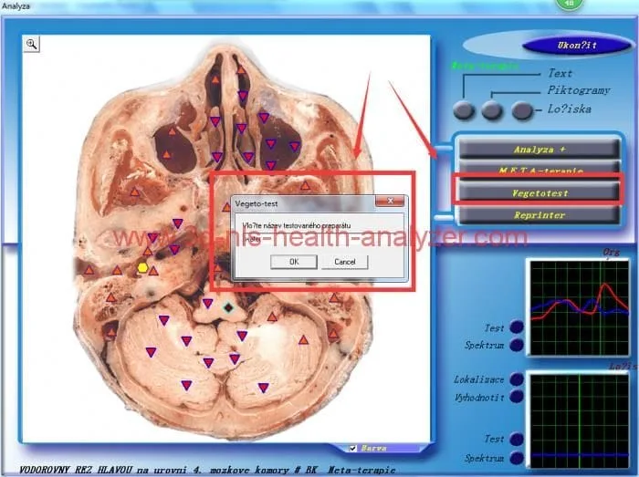 bioescaner 3d