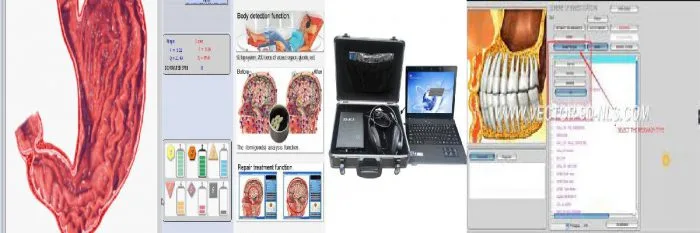 3d nls sub health analyzer
