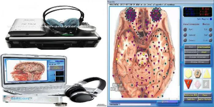3d nls sub health analyzer