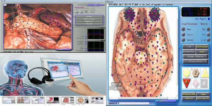 3d nls mra