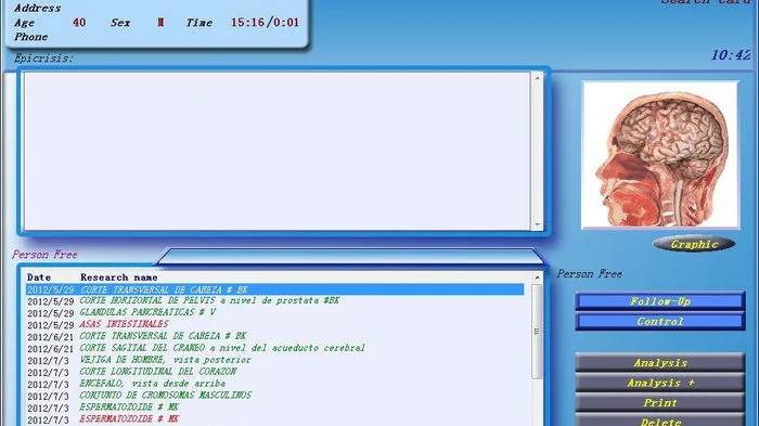 3d nls machine 4
