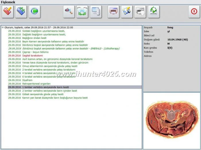 hunter 4025 nls