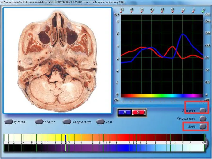 3d nls diagnostika