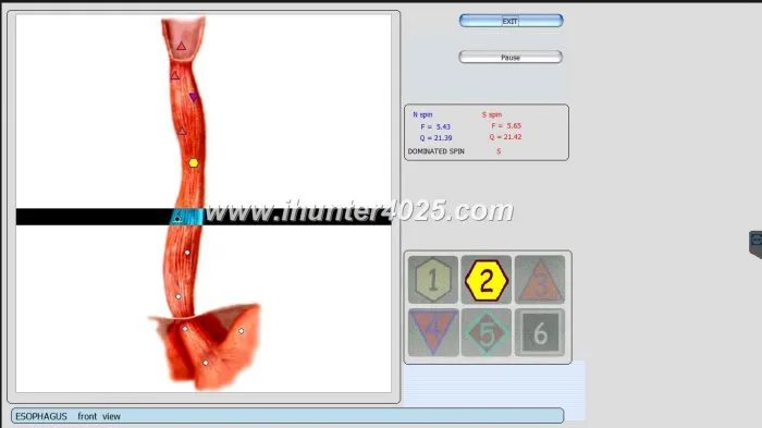 3d nls vs 9d nls 20 Bioplasm 9D NLS