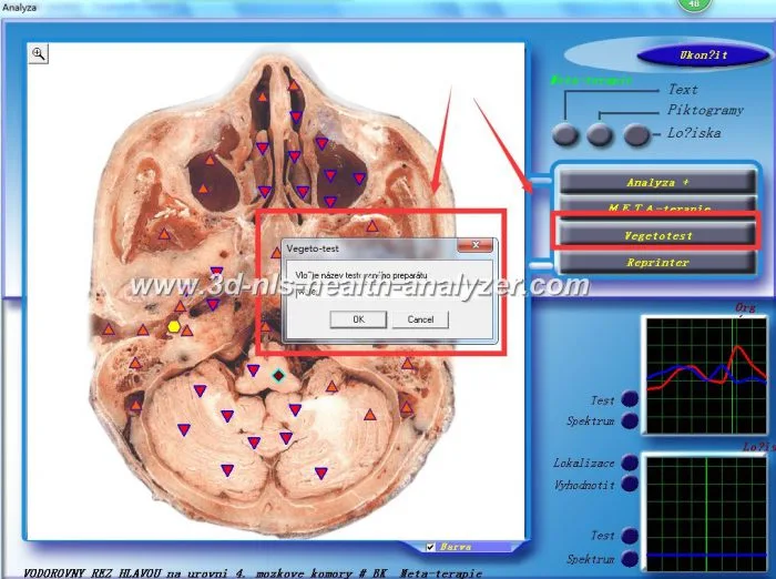 3d nls vs 9d nls 8 Diacom diagnostic machine