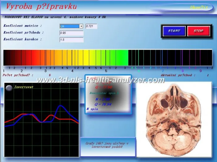 3d nls vs 9d nls 7 Diacom diagnostic machine