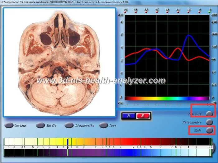 3d nls vs 9d nls 12 Diacom diagnostic machine