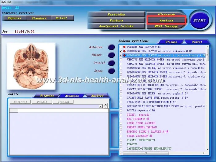3d nls vs 9d nls 11 Diacom diagnostic machine