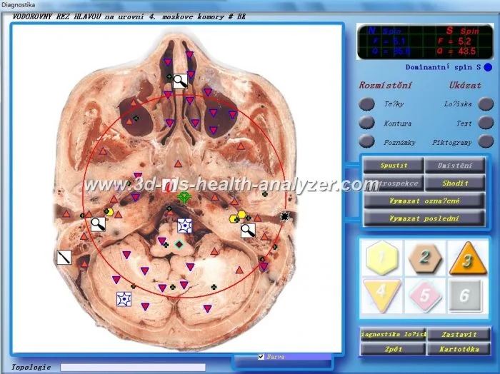 3d nls vs 9d nls 10 Diacom diagnostic machine