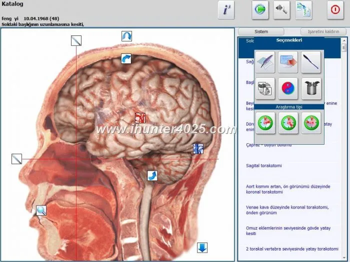 nls diagnostic and analysis