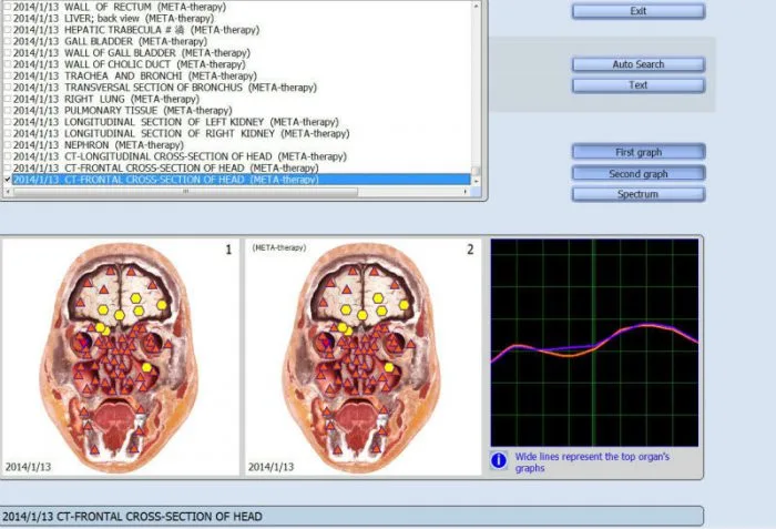 Biorezonans Diacom 3D NLS
