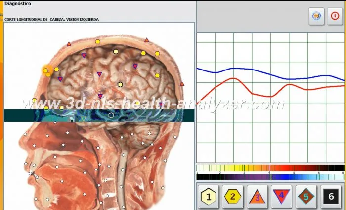 Oberon Metatron Diagnosis Machine