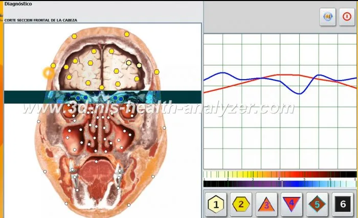 Oberon Metatron Diagnosis Machine