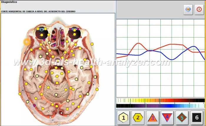 Oberon Metatron Diagnosis Machine