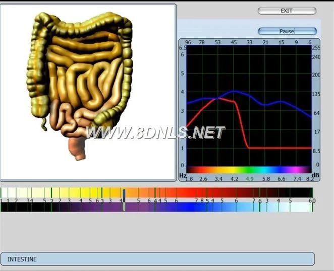 Oberon nls Diagnostic Device