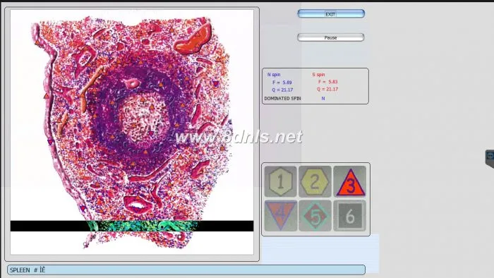 Diacom 3d NLS Software Download
