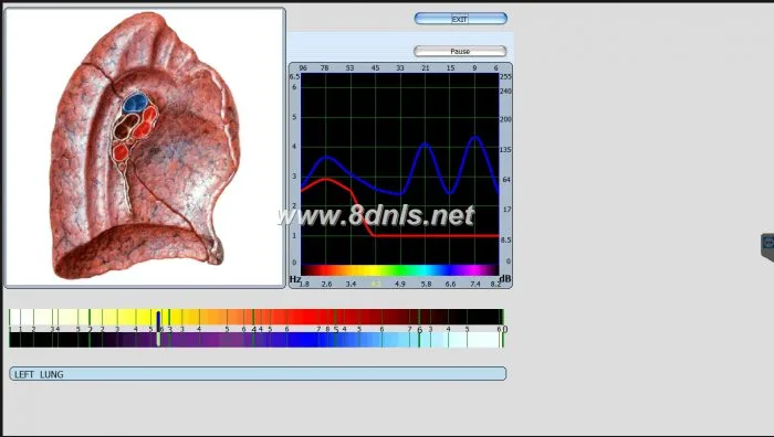 Diacom 3d NLS Software Download