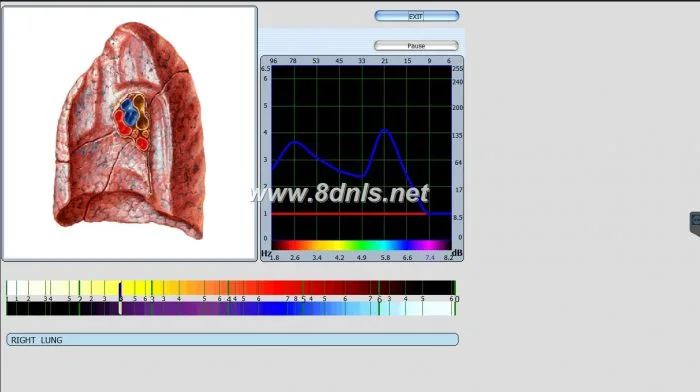 Diacom 3d NLS Software Download
