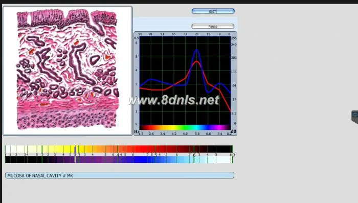 Diacom 3d NLS Software Download