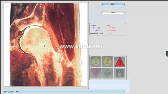 Metatron NLS Review
