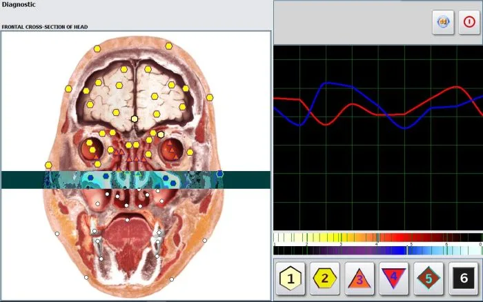 SSCH Metatron Hunter 4025