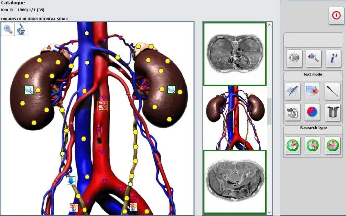 SSCH Metatron Hunter 4025