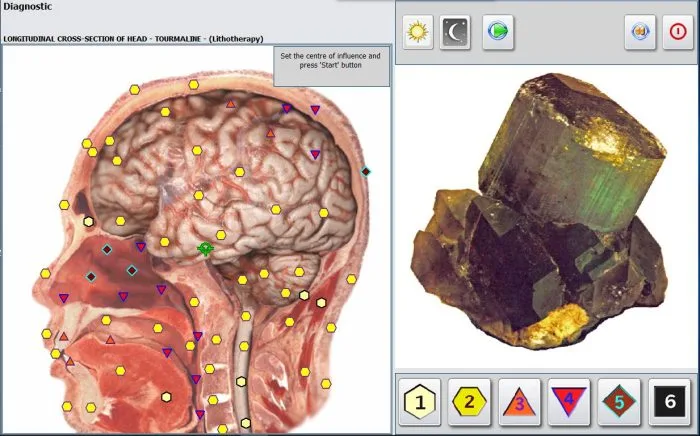 Metatron NLS Scanner