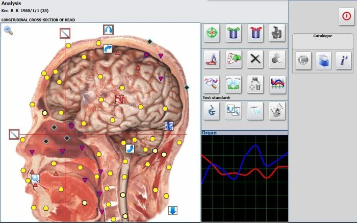 Como Abrir e Instalar Metatron NLS: A Comprehensive Guide