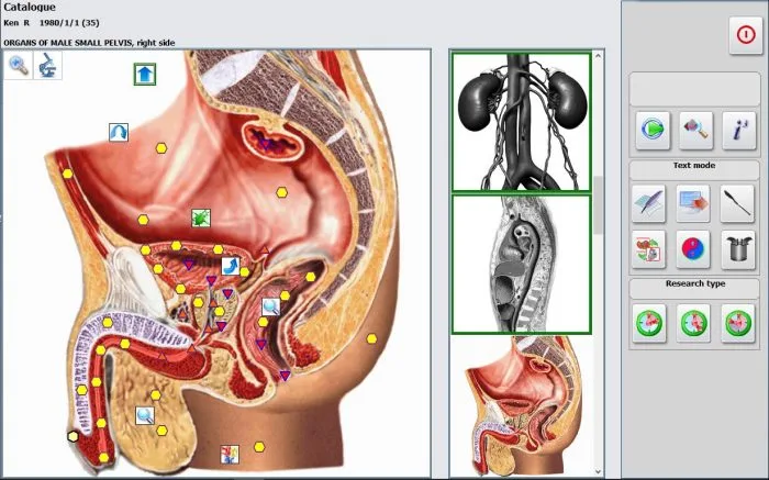metatron hunter 4025 review 18