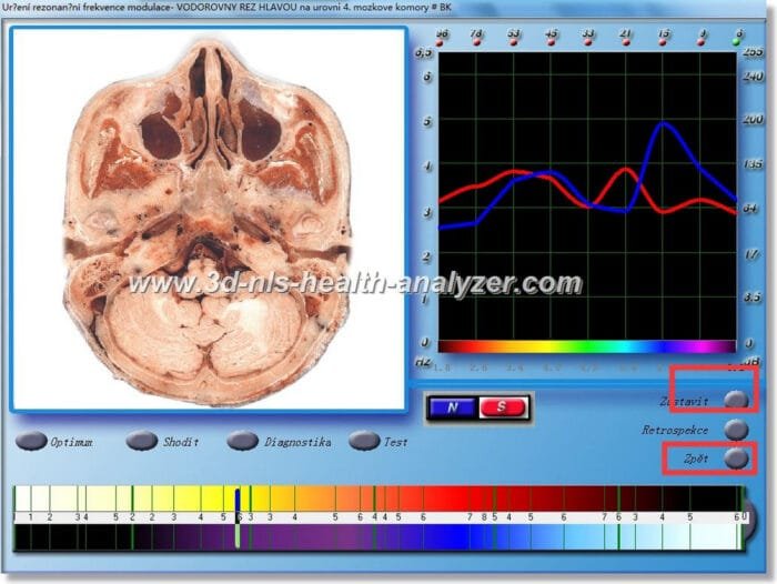 3D NLS Health Analyzer Training