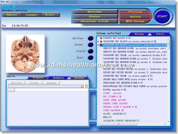 3D NLS Health Analyzer Training