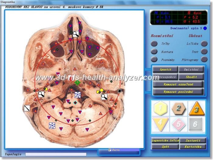 3D NLS Health Analyzer Training