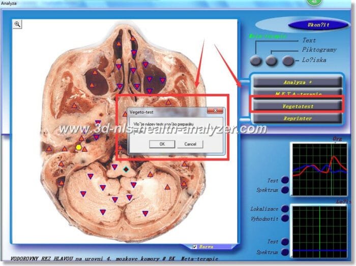 3D NLS Health Analyzer Training