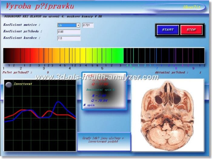 3D NLS Health Analyzer Training