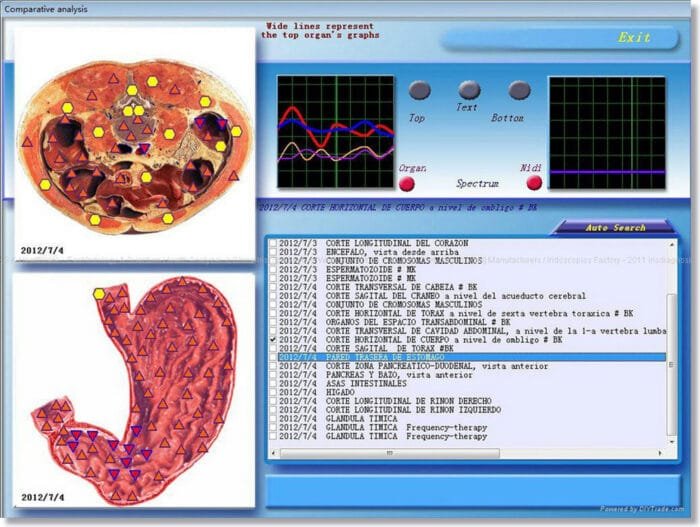 3D NLS Health Analyzer Price