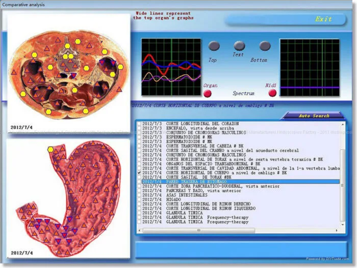 3D NLS Health Analyzer Price