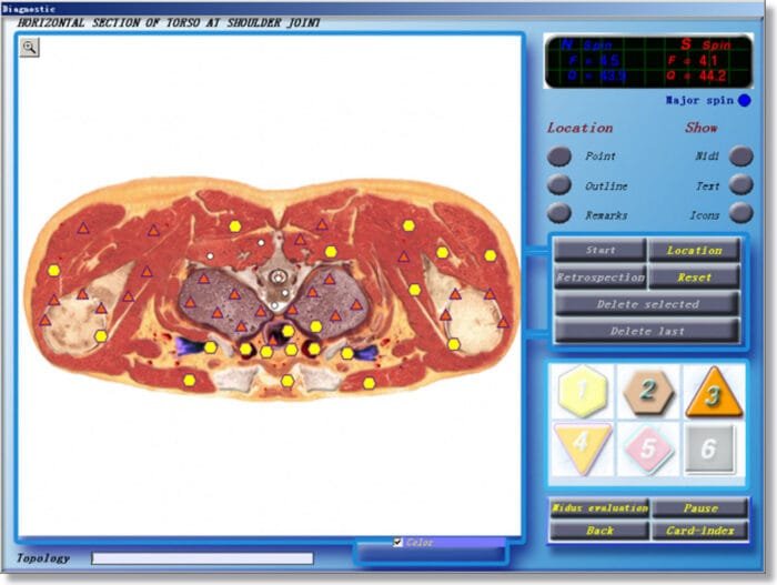 3D NLS Health Analyzer Price