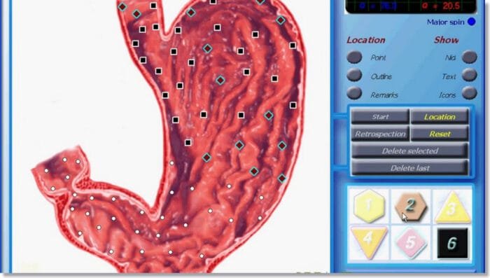 3D NLS Health Analyzer Price