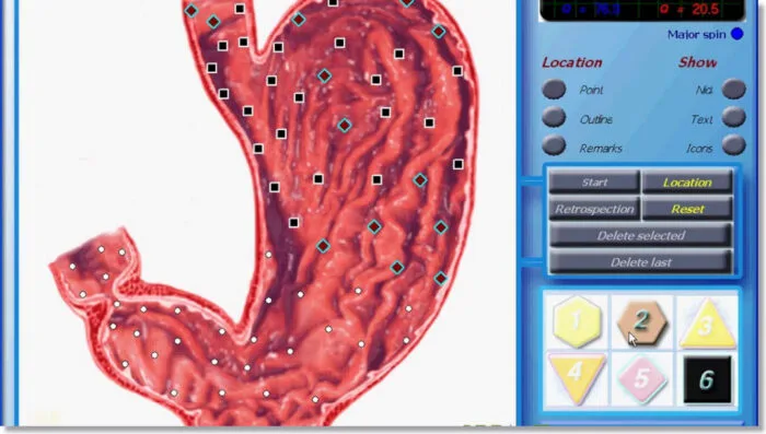 3D NLS Health Analyzer Price