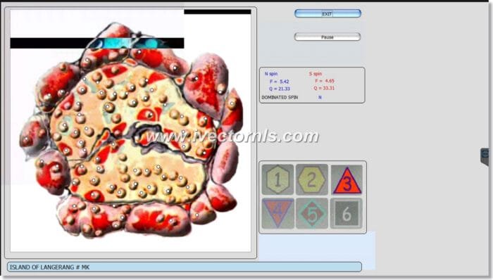 9D NLS Health Analyzer