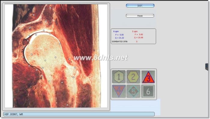 9D NLS Health Analyzer