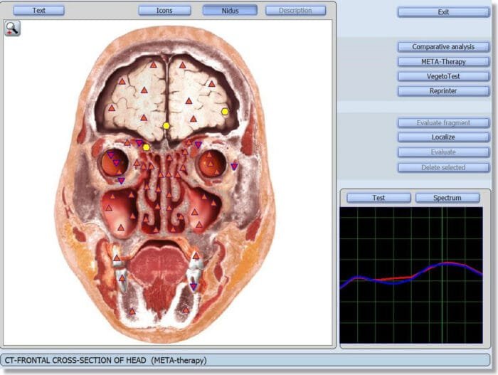 9d nls health analyzer manual pdf 
