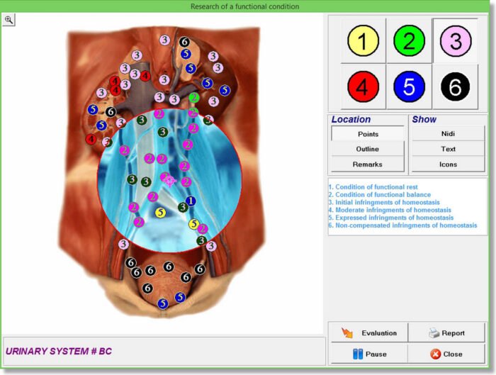 sing bioplasm-8d nls