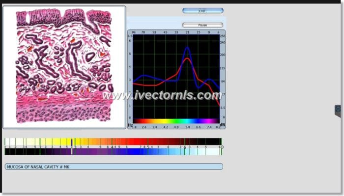 sing bioplasm-8d nls