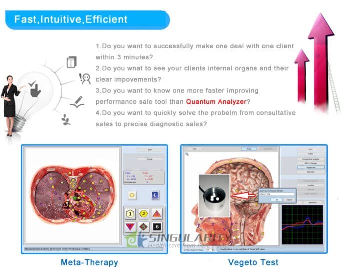What is Diacom NLS 5