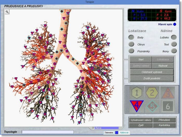 Bioplasm NLS Health Analyzer