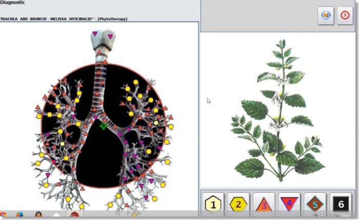 nls diagnostic system