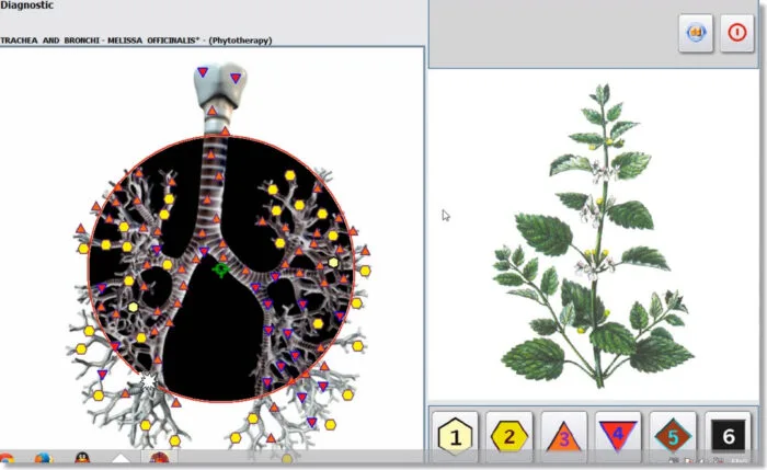 nls diagnostic system