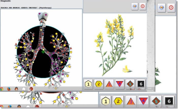 nls diagnostic system